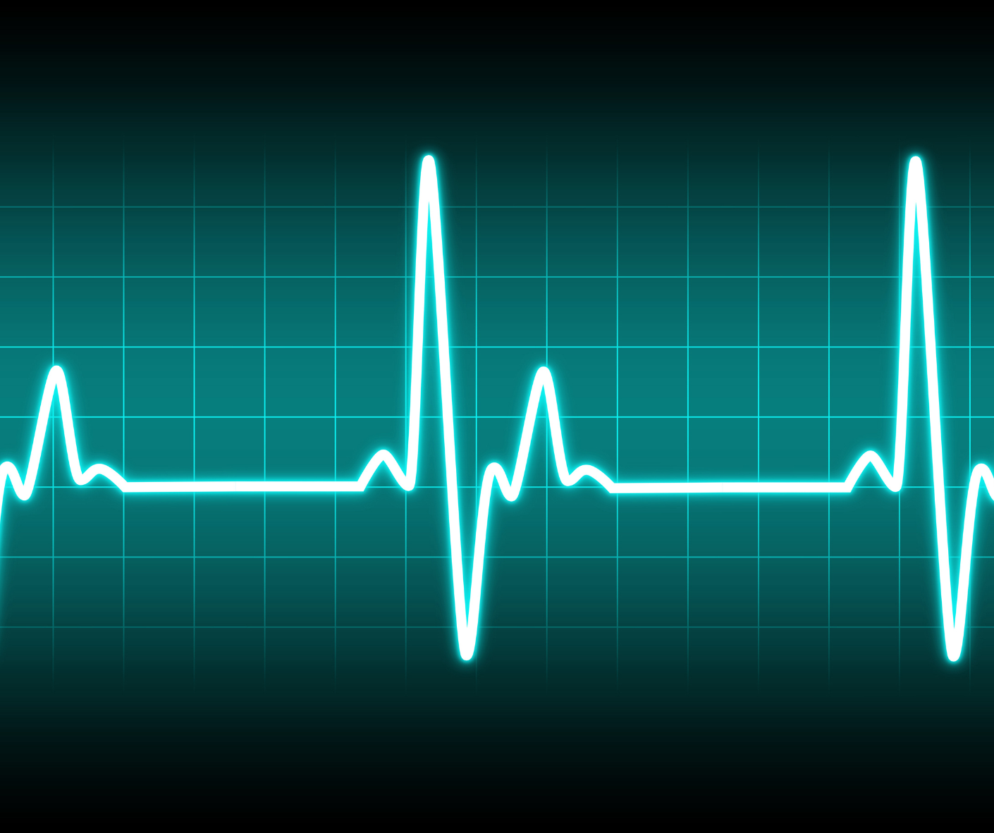 Herzfrequenzüberwachung